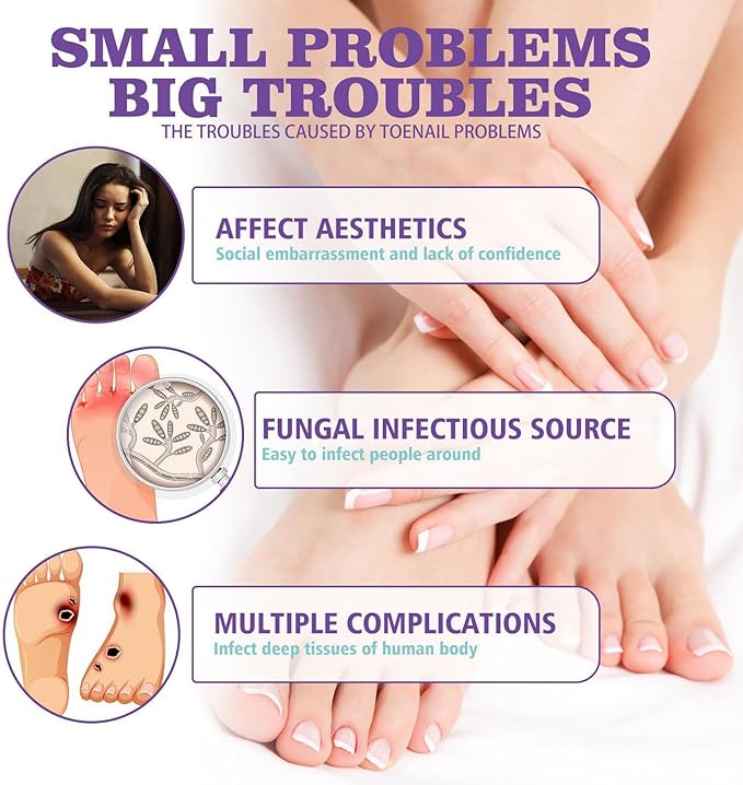 Jaysuin - Nail Fungus Spray (Original)