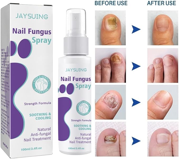 Jaysuin - Nail Fungus Spray (Original)