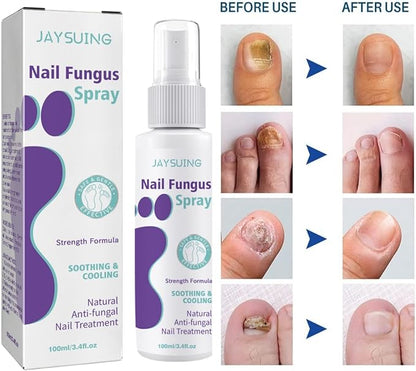 Jaysuin - Nail Fungus Spray (Original)