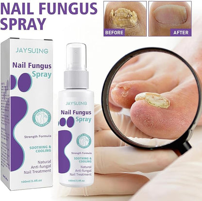 Jaysuin - Nail Fungus Spray (Original)